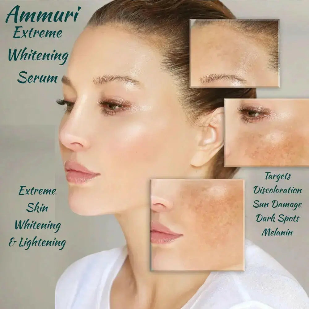 Ammuri Extreme Lightening Serum – Intense Dark Spot Corrector for Face, Neck & Intimate Areas (30ml)