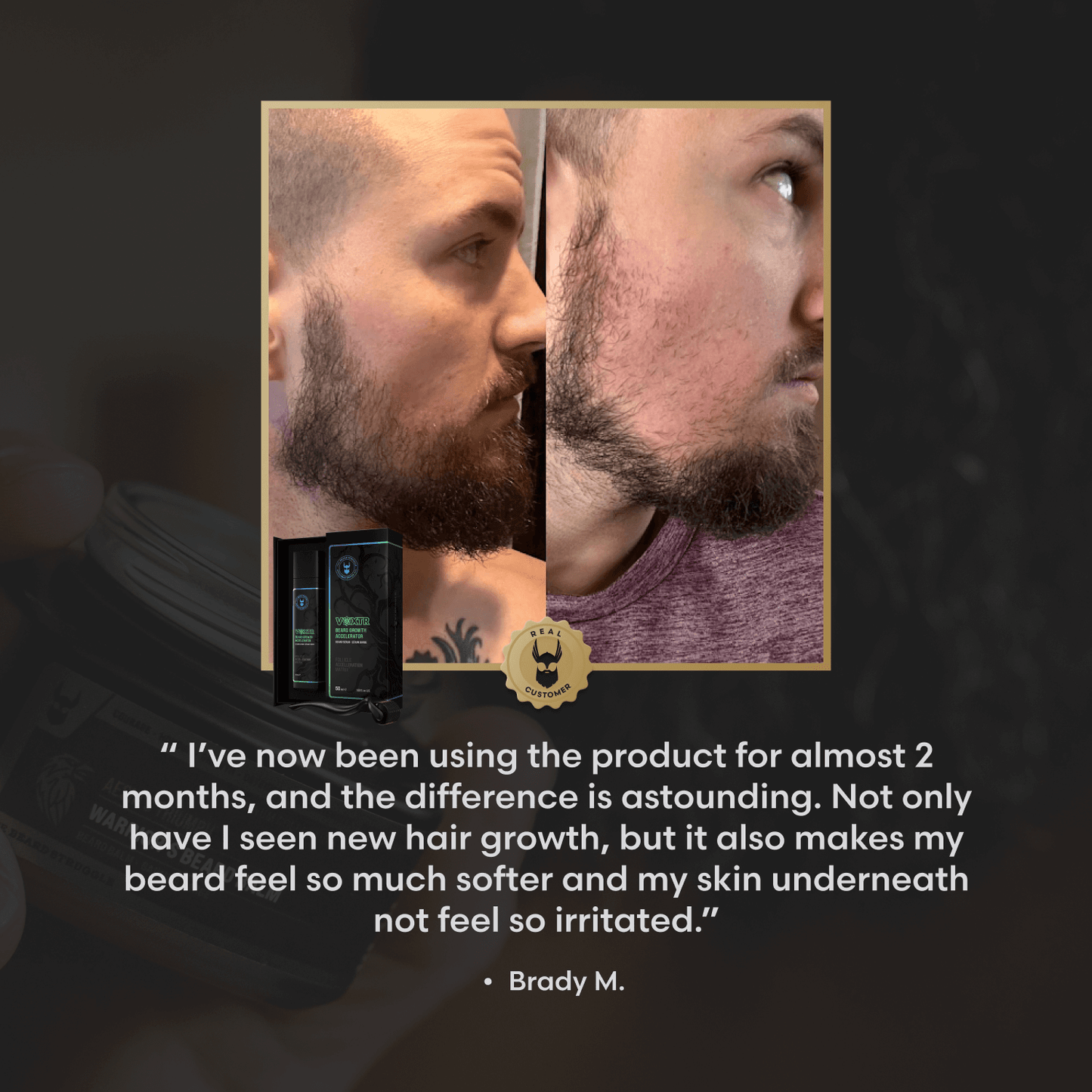Voxtr Beard Growth Kit