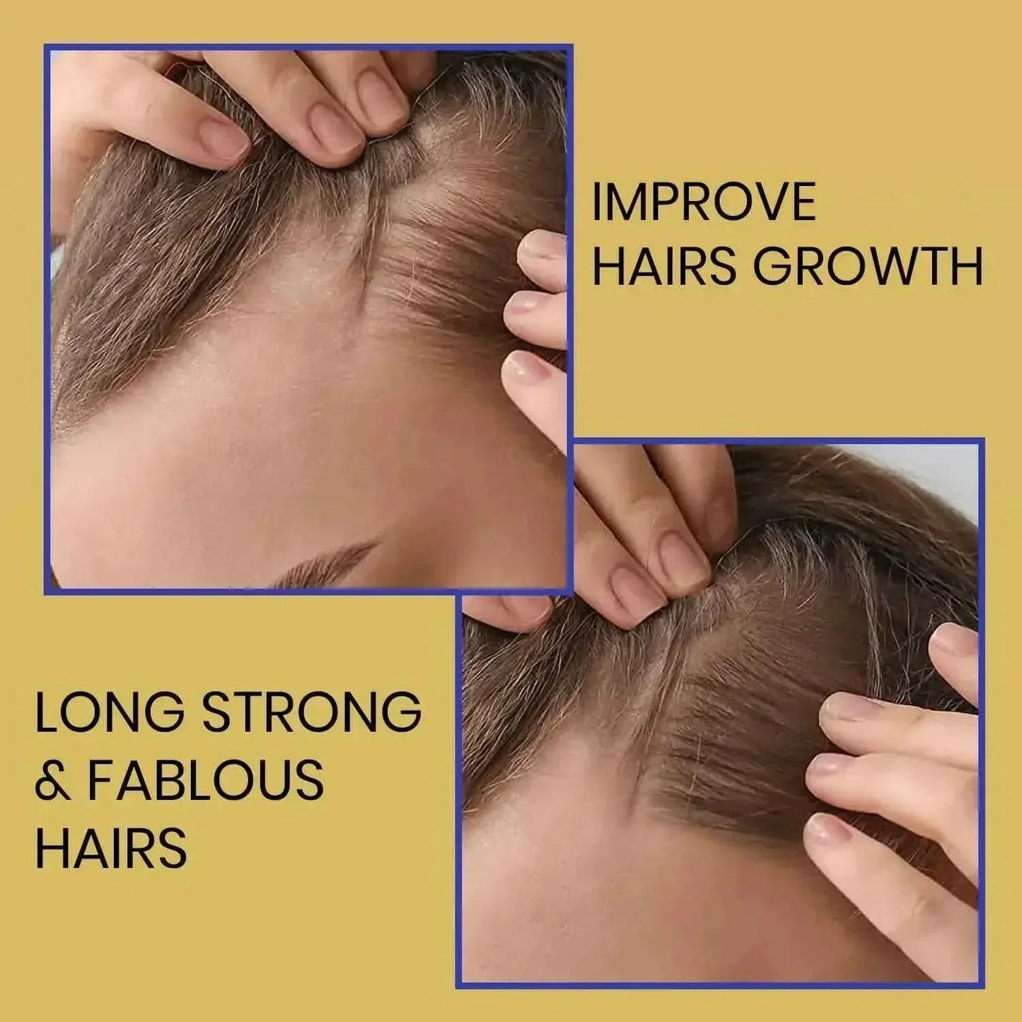 Ammuri Biotin Haircare Set – Anti-Hair Loss Shampoo & Strengthening Hair Serum for Men & Women