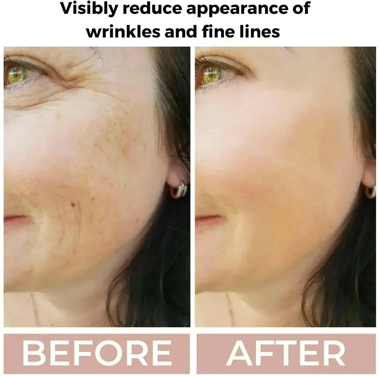 Ammuri Skincare Anti Aging Face Serum - High Volume Retinol 3.5%