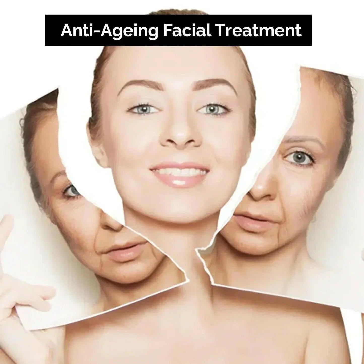 Ammuri Intense Lightening Skin Cream – Brightening for Bikini, Underarms & Sensitive Areas (50g)