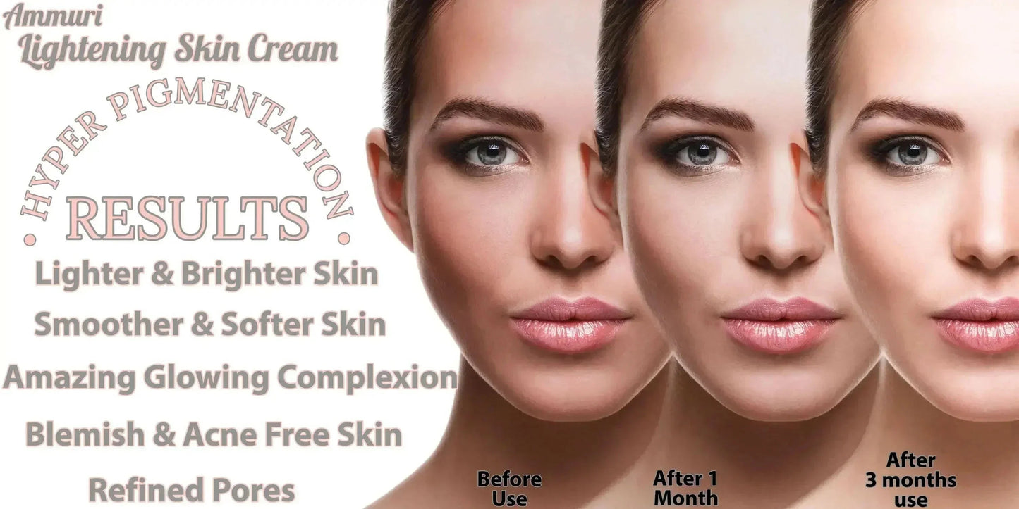 Ammuri Intense Lightening Skin Cream – Brightening for Bikini, Underarms & Sensitive Areas (50g)