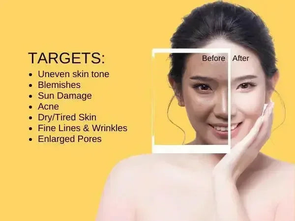 Ammuri Vitamin C Day Cream SPF 50 for Radiant Skin