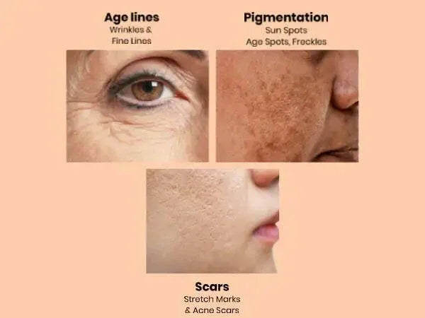 Ammuri Retinol Apple Stem Cell Age Reverse Cream