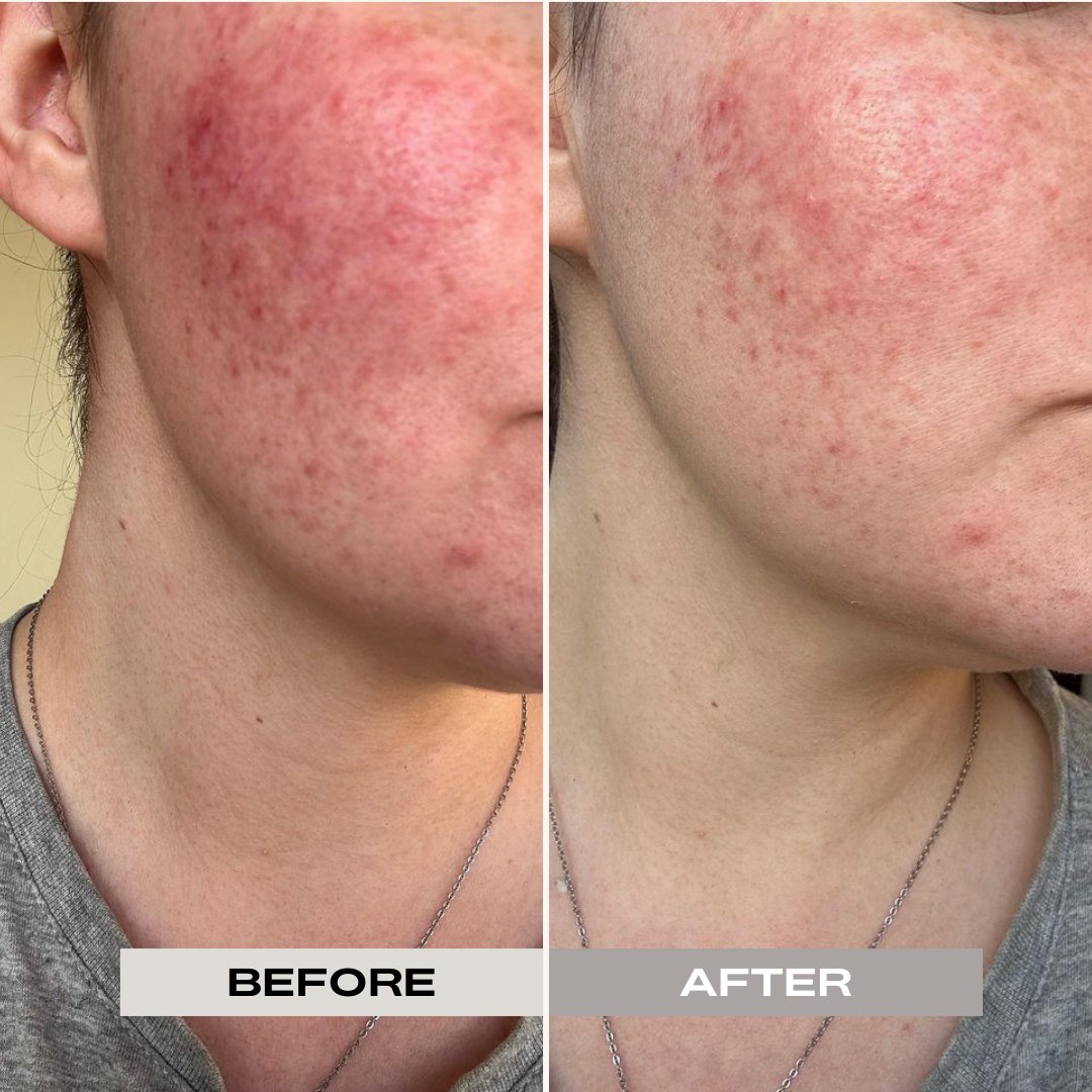 FRENCH GREEN CLAY MASK & CALMING MASK OIL SET