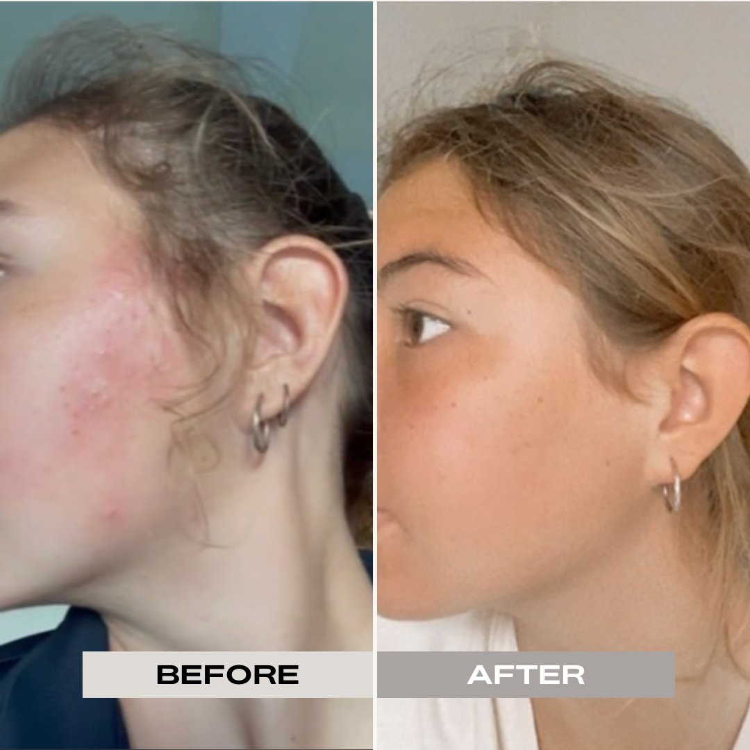 FRENCH GREEN CLAY MASK - REFILL